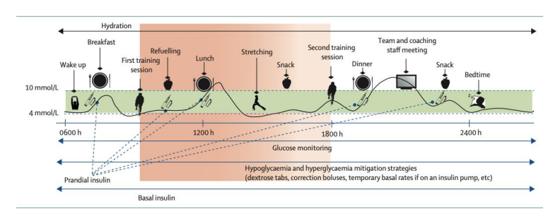 Dietary Approaches in Endurance Athletes with Diabetes – Nutritional Support